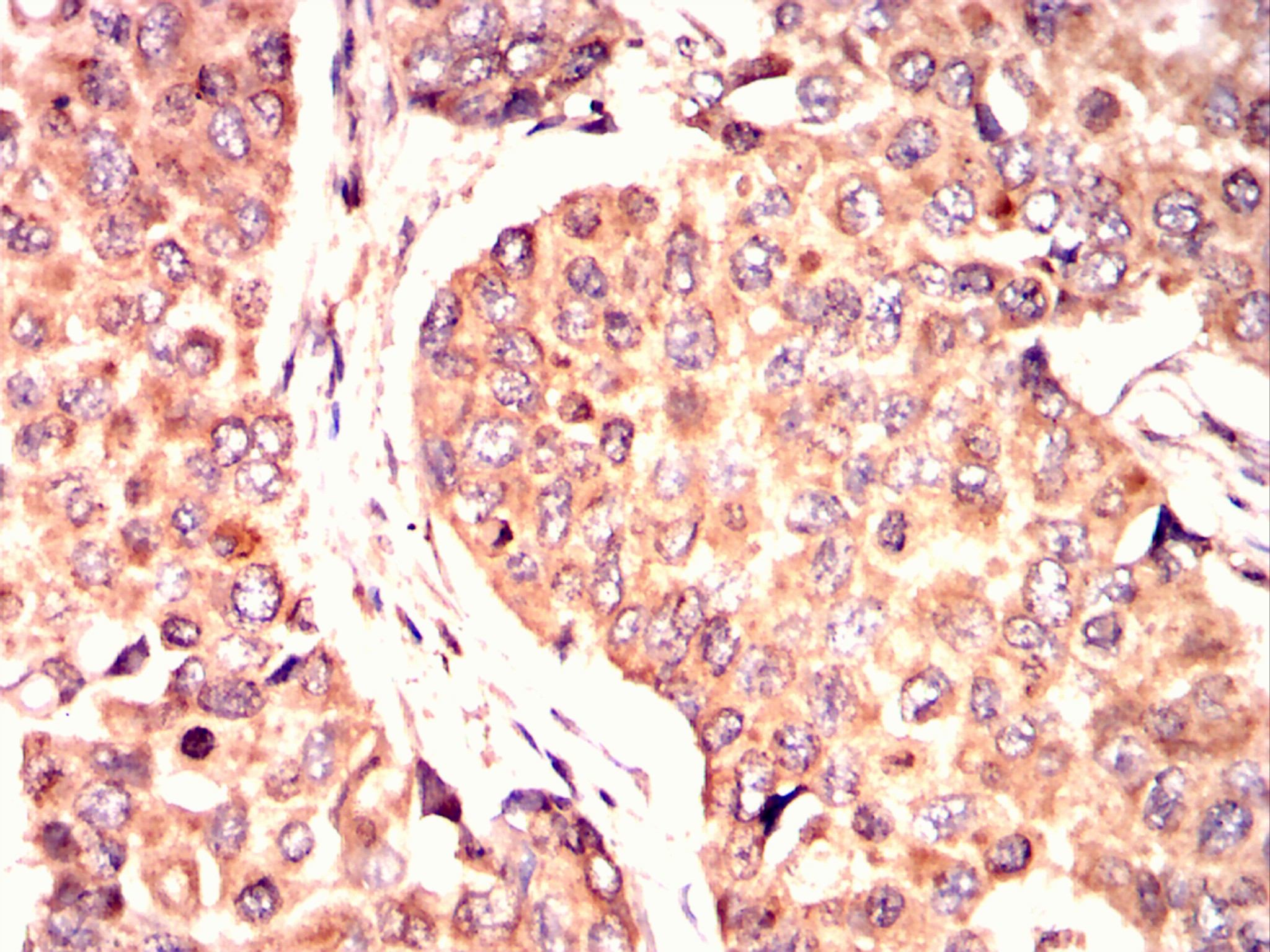 		IHC